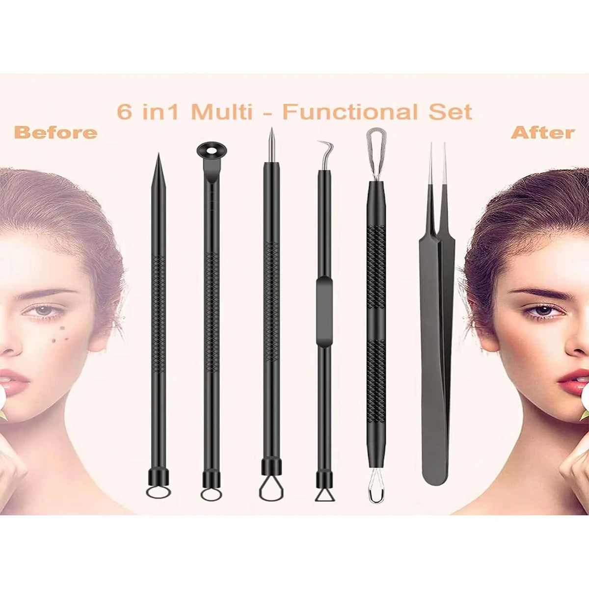 PORE PRECISION™ ACNE REMOVAL KIT
